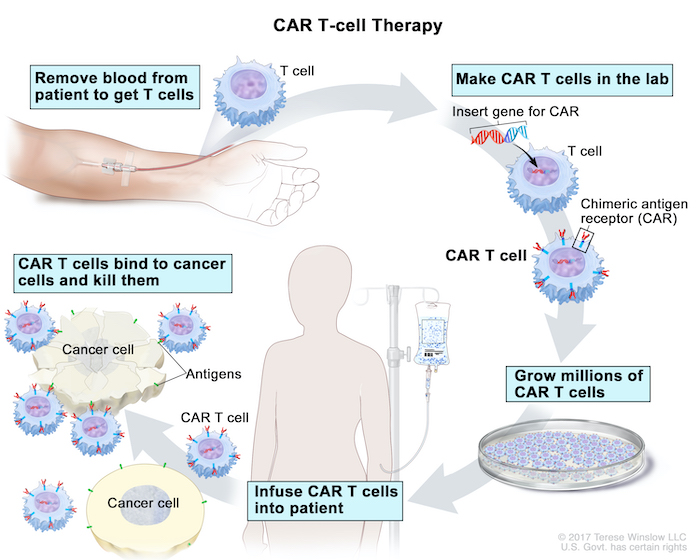 CAR TCell Therapy for Cancer OHSU